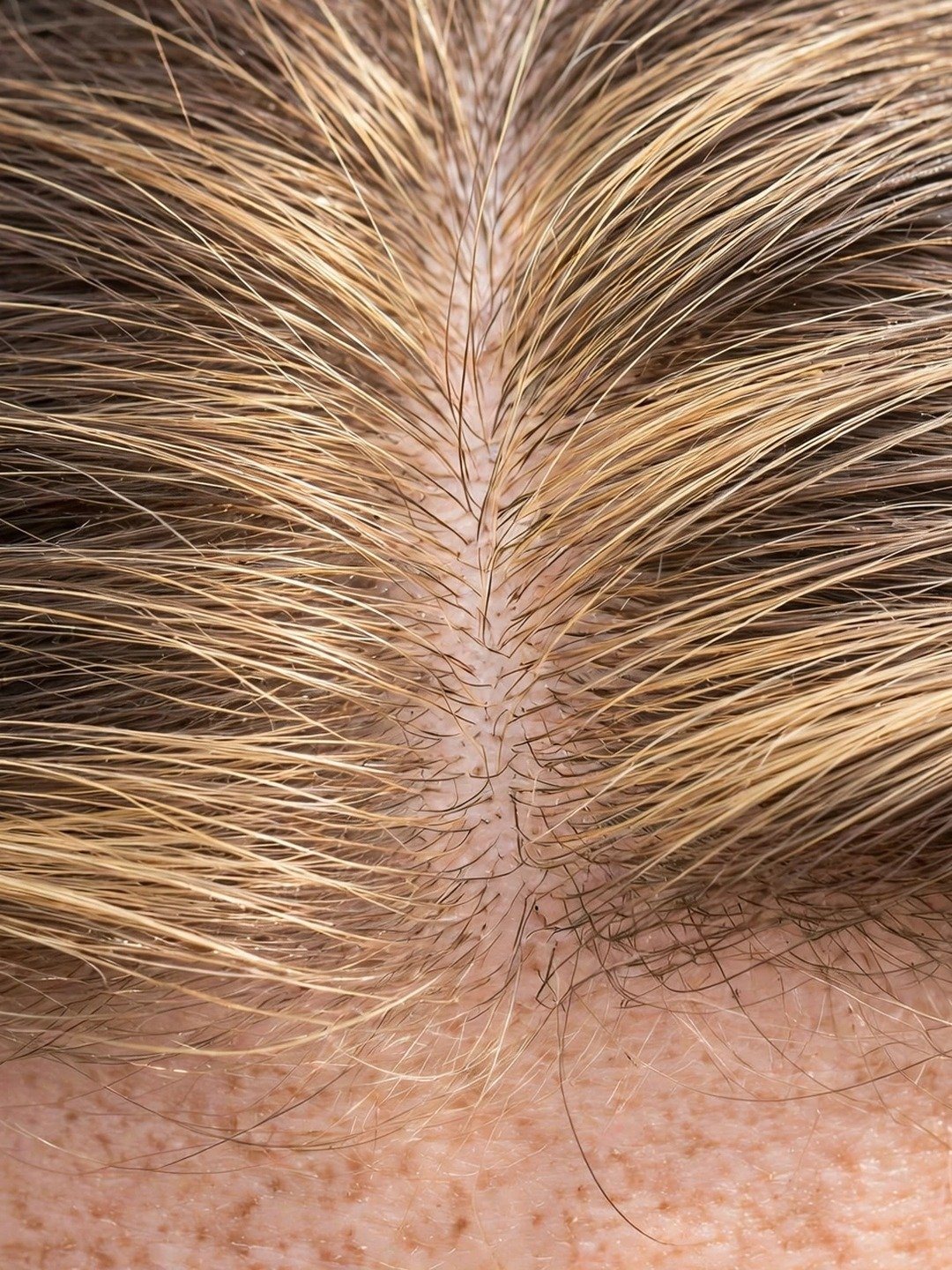 Honey Blonde Babylights